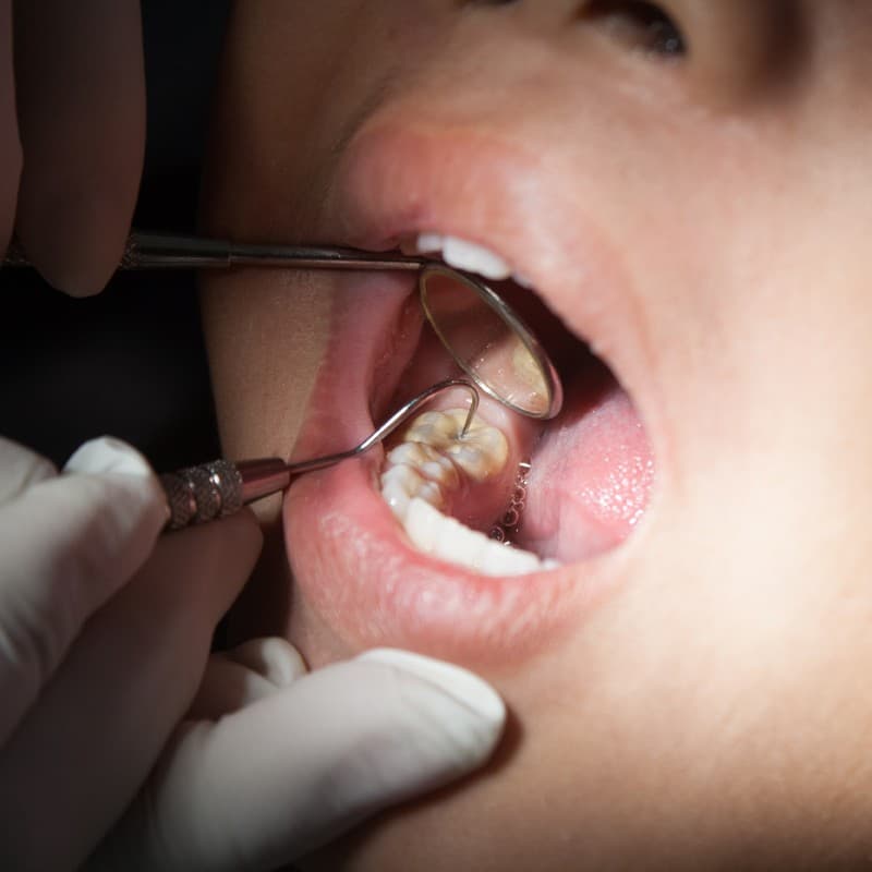 dentista niños  en Vigo