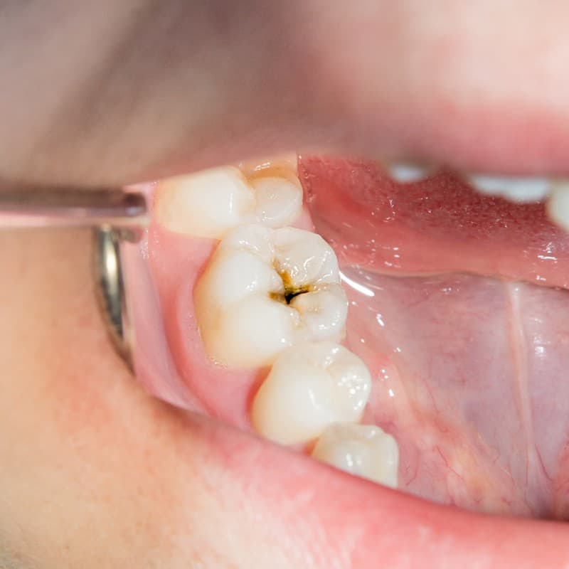 dentista niños  en Vigo