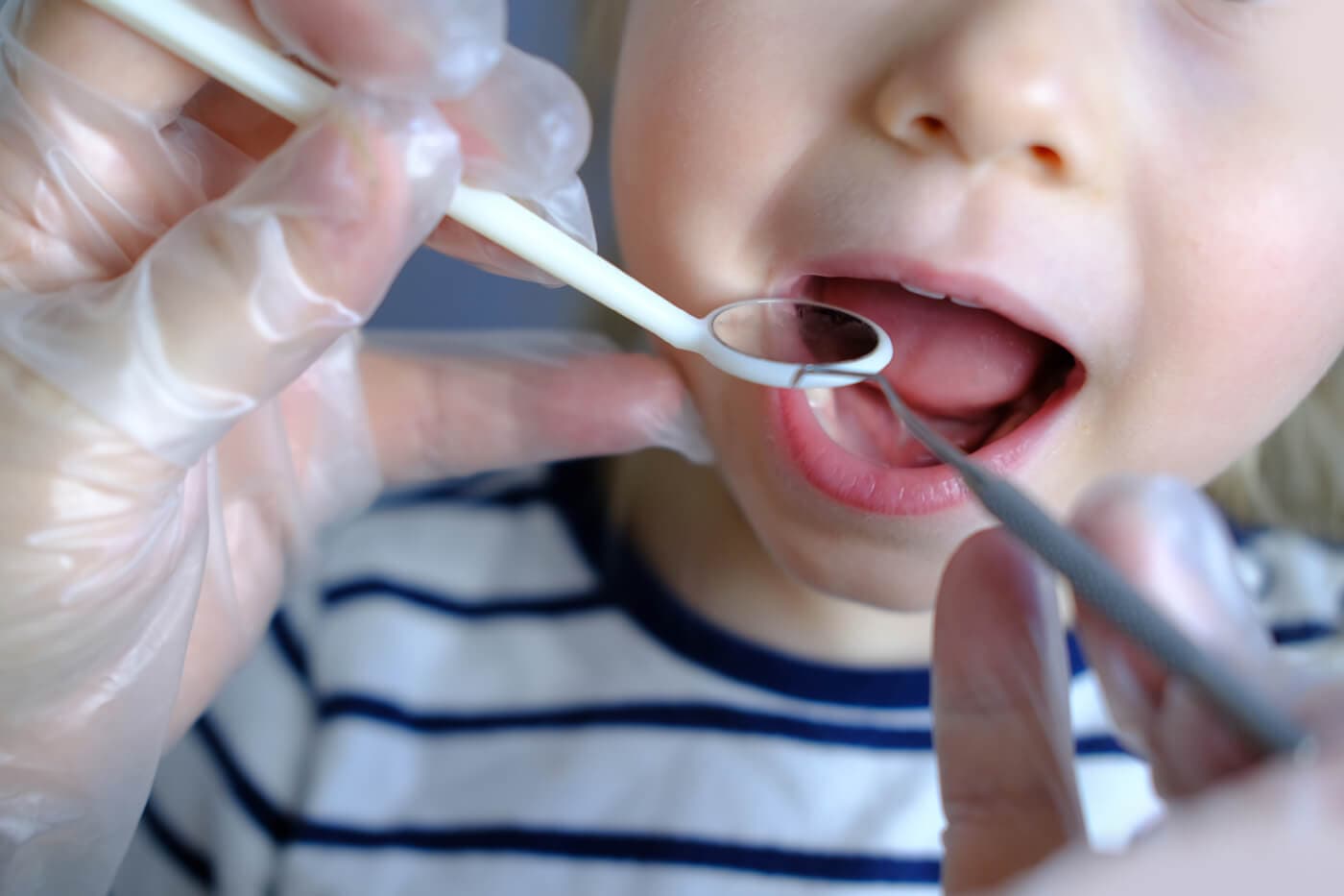 Tratamientos de odontología infantil